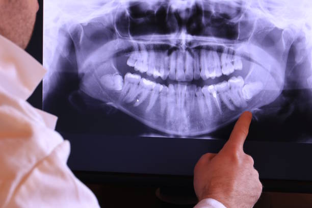 Best Emergency Root Canal Therapy in Robins Af, GA