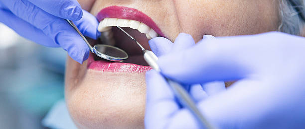 Best Emergency Dental Care for Sports Injuries in Robins Af, GA
